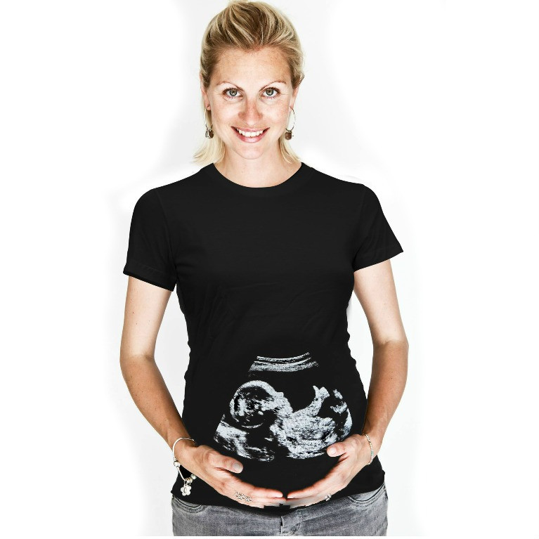 baby scan t-shirt